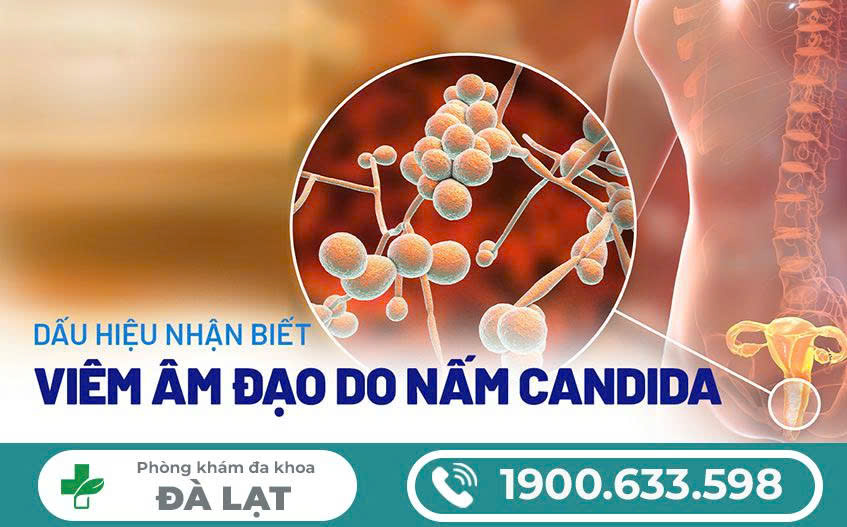 Hình ảnh minh họa